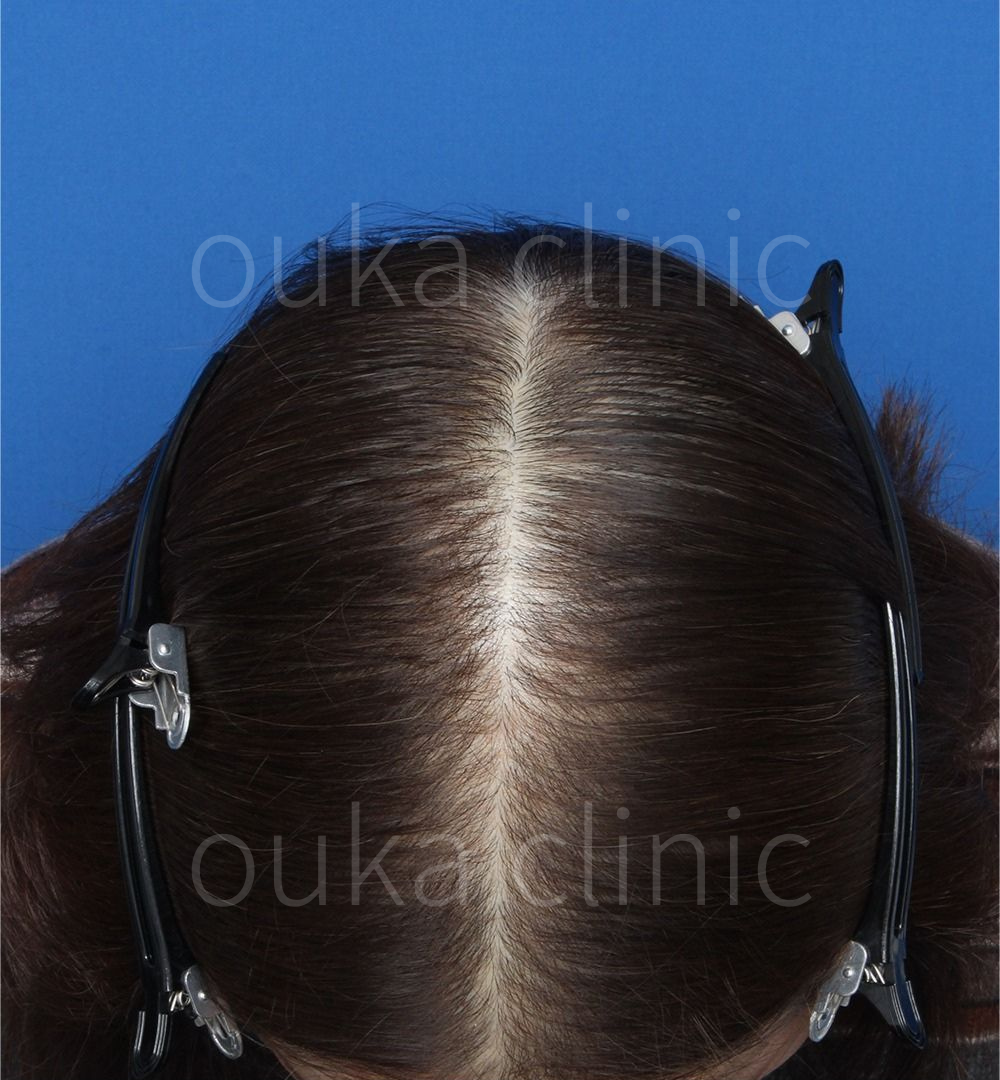 全体の治療後の画像